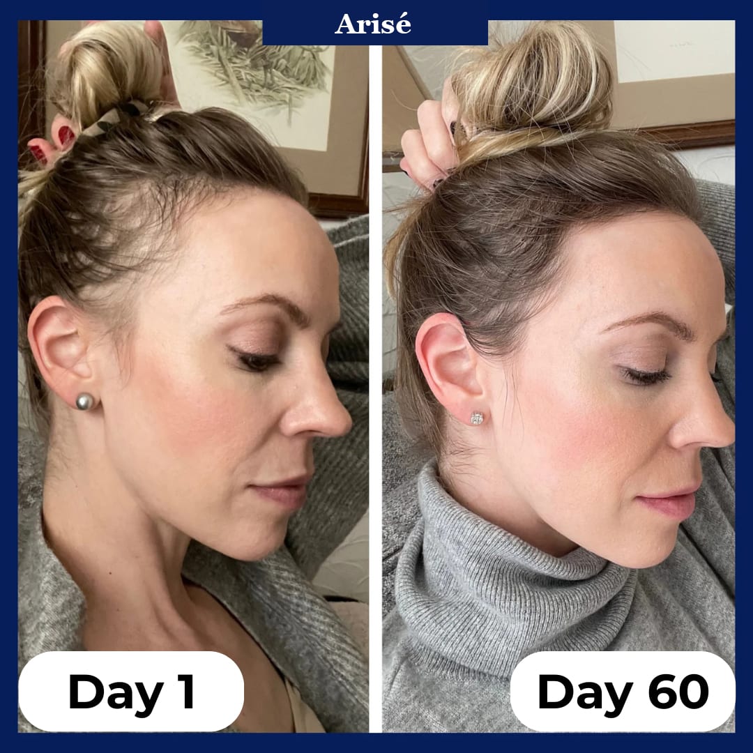 Arisé Hair Growth Serum Roll